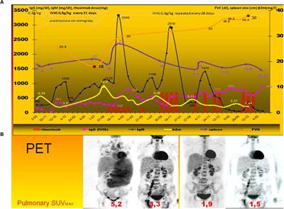 Lymphoid Interstitial Pneumonia in Common Variable Immune Deficiency – Case Report With Disease Monitoring in Various Therapeutic Options: Pleiotropic Effects of Rituximab Regimens